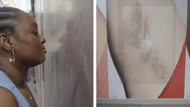 Billie secoue la pub avec des aisselles géantes à gratter… et ça sent bon le soleil !