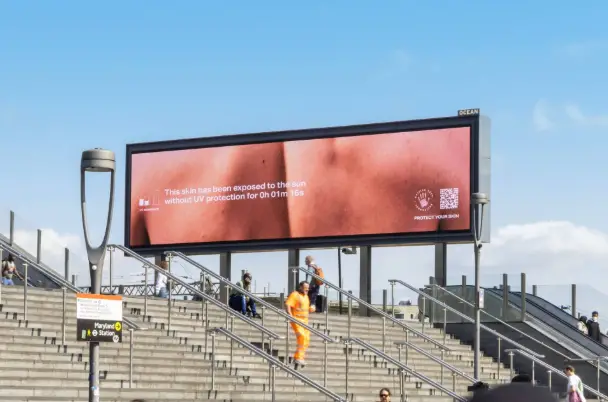 Affiche DOOH à Londres montrant une peau qui rougit sous les UV en temps réel
