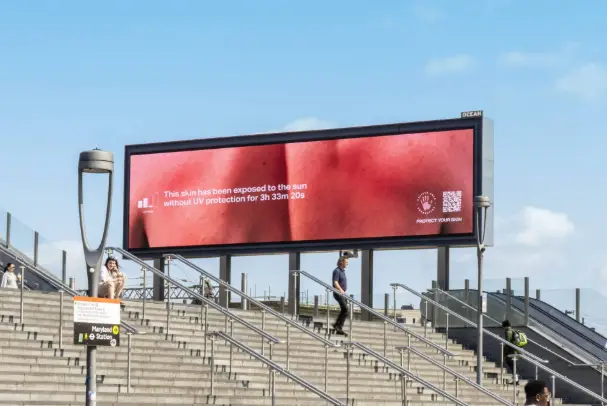 Affiche DOOH à Londres montrant une peau qui rougit sous les UV en temps réel